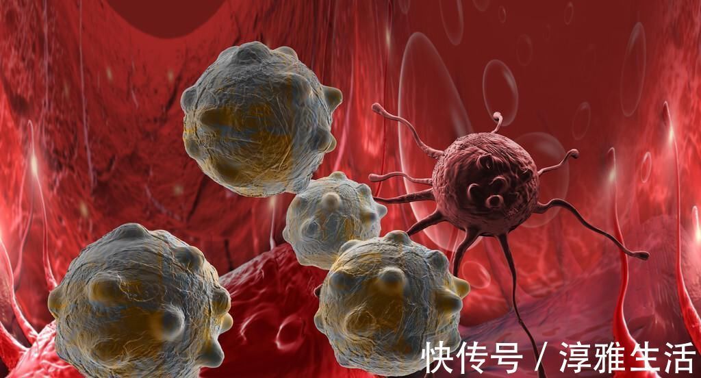 癌细胞|50岁阿姨患癌十几年未复发,全靠这3个好习惯,癌症患者受益了