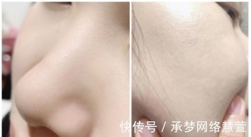 敏感肌 一定要告诉你这5款护肤品测评!给你选出最适合自己的那一款!