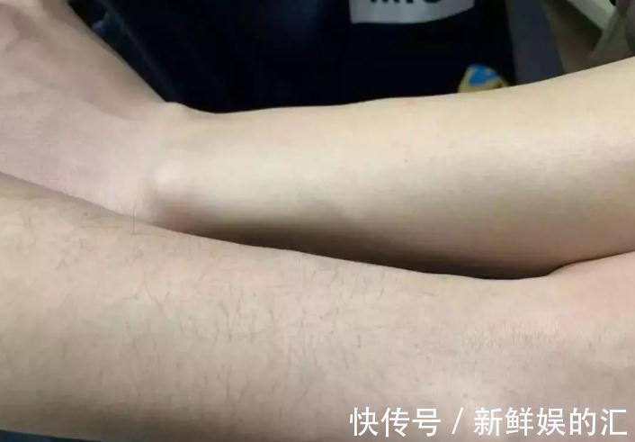 饮食习惯|为什么有的女性体毛旺盛,有的“光秃秃”的?这是什么原因呢?