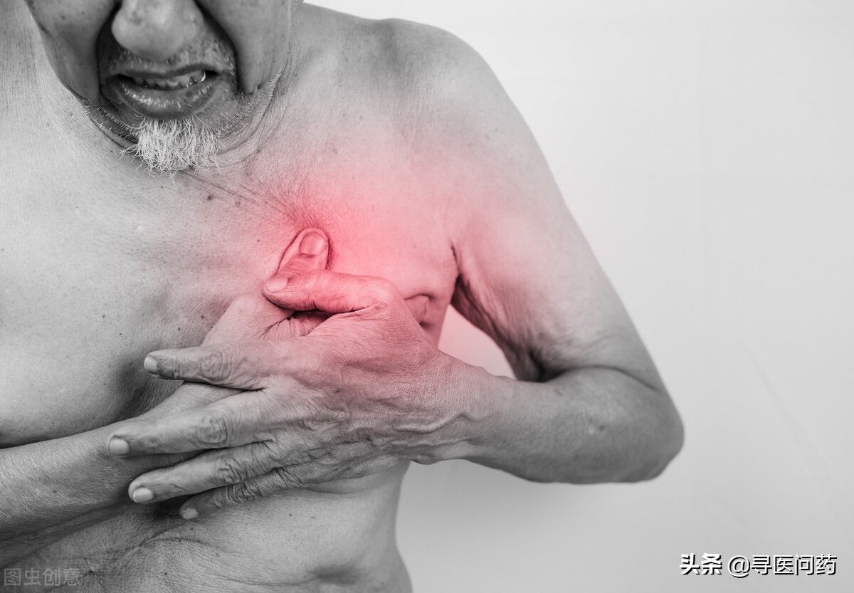 筛查|男性注意，乳腺癌男性也会得，死亡率比女性更高