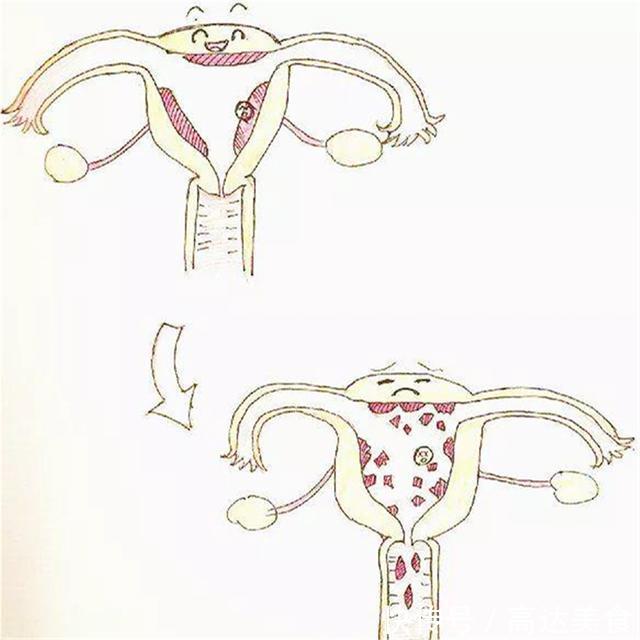 子宫内膜|为何用验孕棒测出“两道杠”,没过几天月经又来了是流产了吗