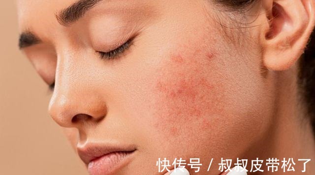 护肤 换季是改善皮肤的好时候,这些护肤技巧学会了,平稳度过换季期!