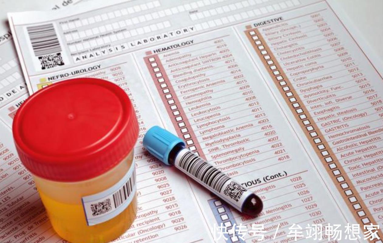 不良习惯|高尿酸的祸根不止是酒，这4类食物也要注意，教你正确方式降尿酸