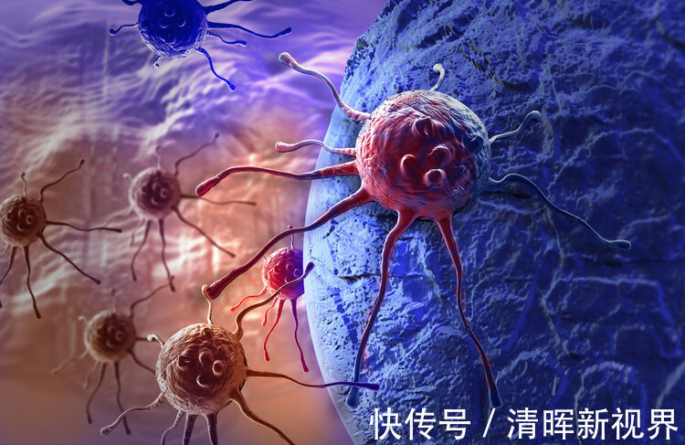 癌症|29岁男教师天天跑步、健身锻炼，最后还是患上癌症，只剩几个月