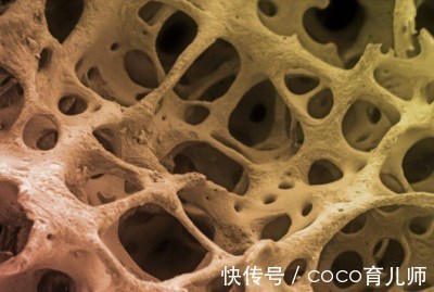 中老年人|提醒中老年人：3类食物或会“加速”骨质疏松，你知道是什么吗？