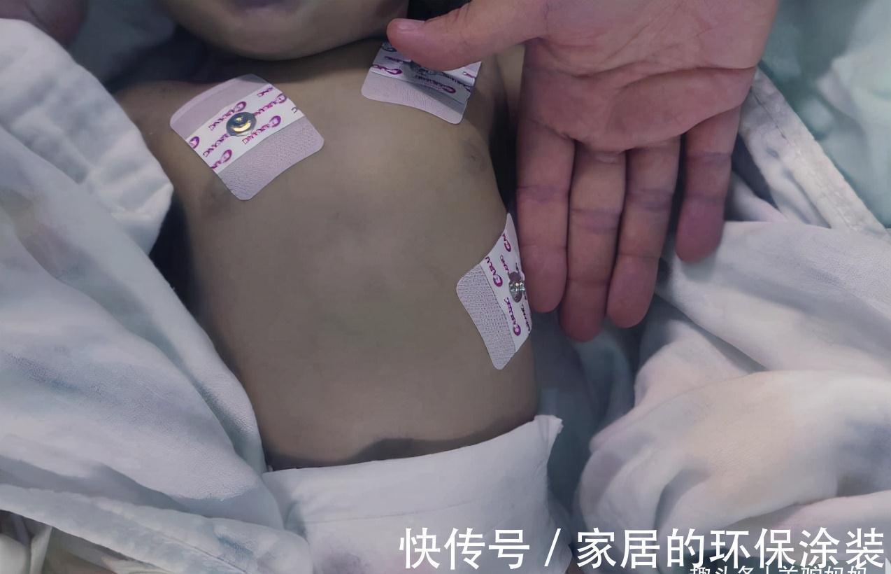 父母|用“菜汤”给宝宝冲奶粉能“清火”?父母别再犯傻,这行为很伤娃