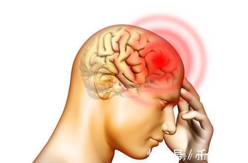 脑中风|脑供血不足，易诱发脑梗或中风，10个现象出现2个以上，要注意