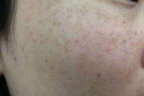 内分泌|子宫“堆满垃圾”的女人,脸上多有这些“痕迹”,外人一眼能看出