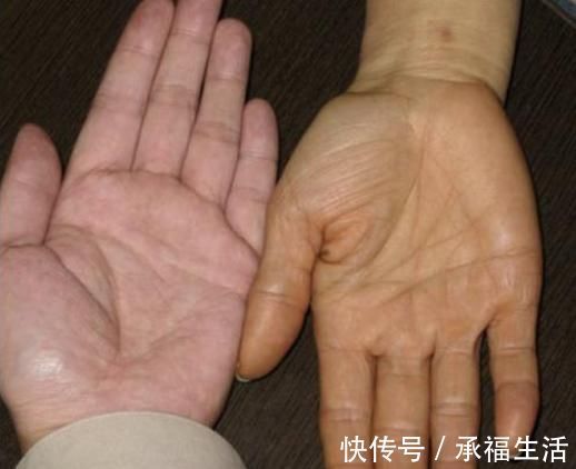 肝气郁结|早晨是养肝“黄金期”,4种早餐1种零食可劲吃,肝脏会很高兴