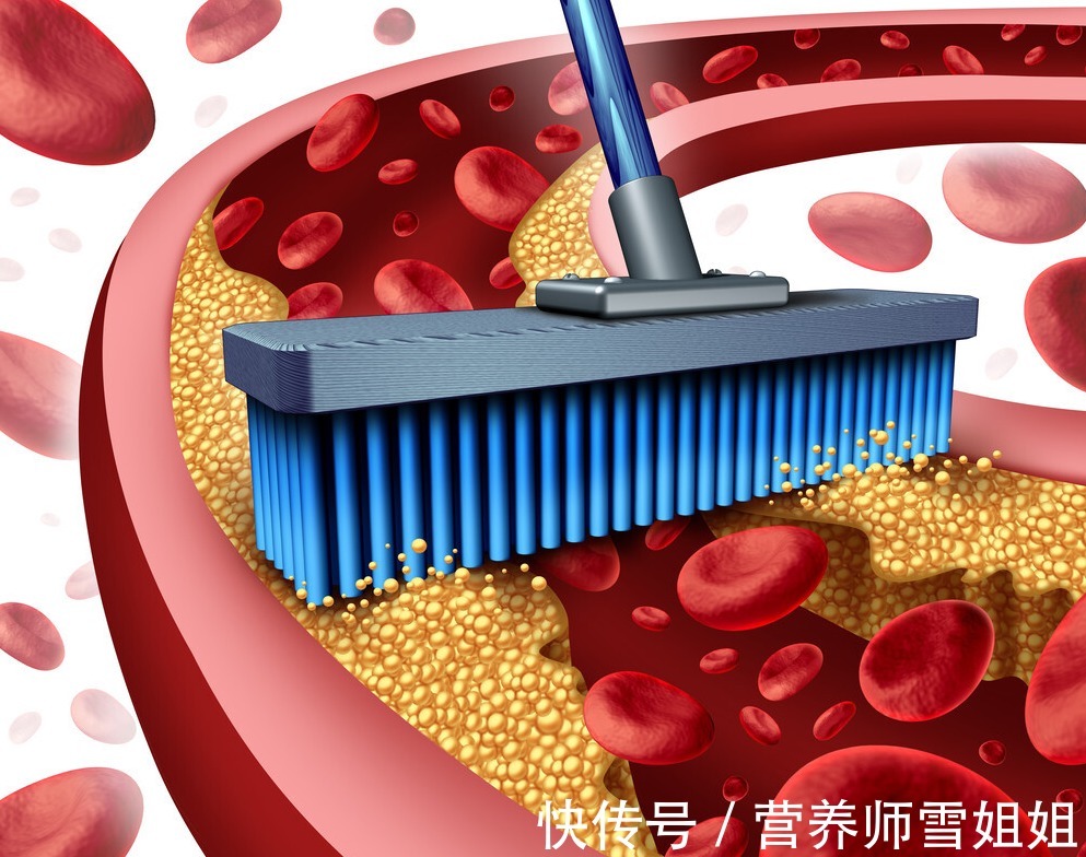 血管|入春后,养血管,少碰二物,做好三补,坚持四勤,血管通畅人长寿