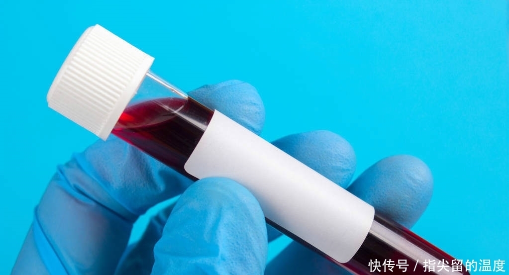 老孙|65岁男子确诊晚期尿毒症,只因长期保持一种习惯,最好及时检查