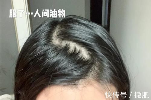 头发|头发经常出油看上去很邋遢?女生做到这些,不用每天洗头也很清爽