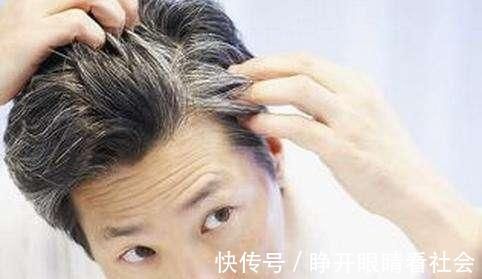 食物|头发白了别急着染, 多吃这几种食物, 还你一头乌黑靓丽的秀发
