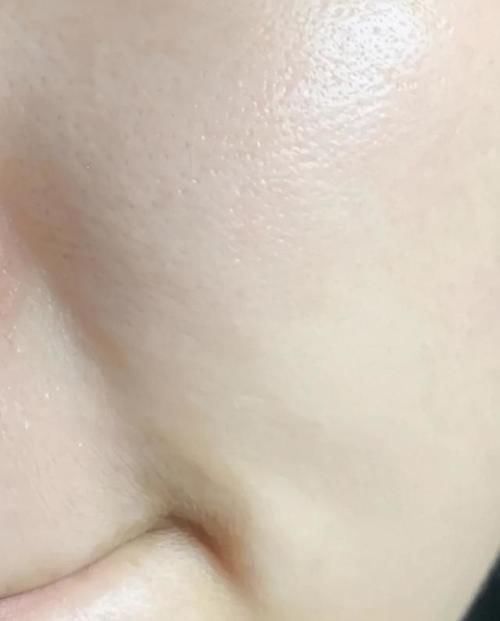 “刷酸”产品千千万，我最爱的还是这3款，真的养出了“牛奶肌”