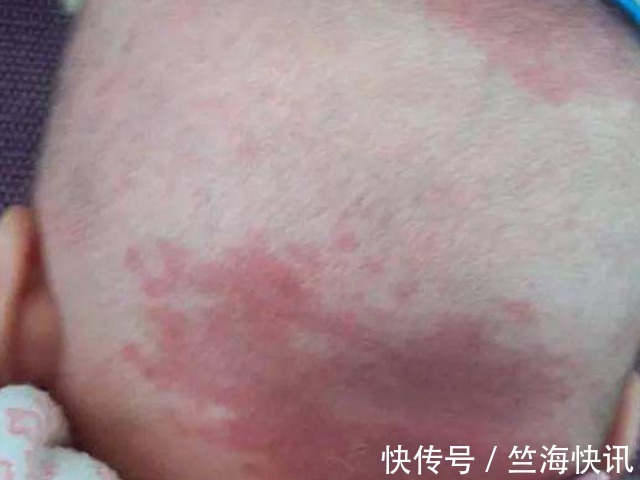 女人|女人怀孕后,尽量不要做4件事,以免宝宝脸上长胎记,别不当回事