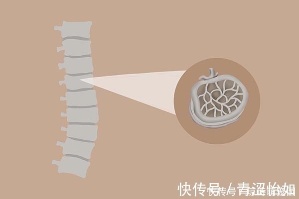 骨质|50岁后,骨质渐渐流失,吃哪些食物能预防疏松?医生列出了清单
