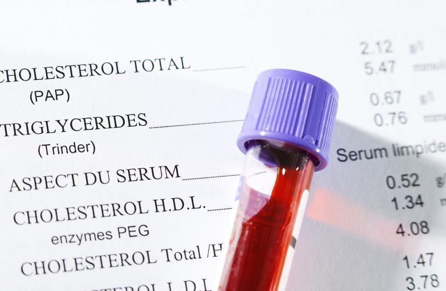 优质蛋白|甘油三酯的“帮凶”就在身边3种食物不节制,甘油三酯越来越高