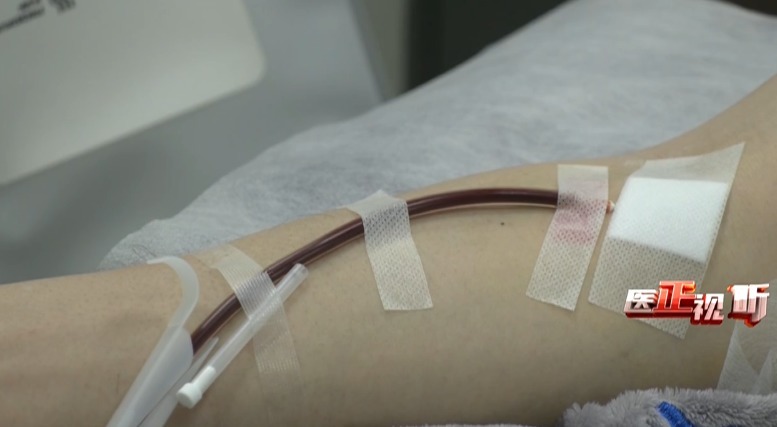 输血者|直系亲属之间能输血吗?医生:这种情况下不建议