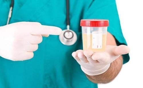 糖尿病人泡沫尿时有时无,是什么原因?本文为你说清