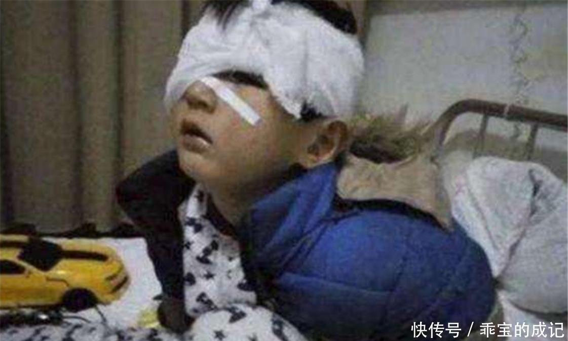 生命线|孩子身上这4个部位,个个都是生命线,家长再生气也不要动手打