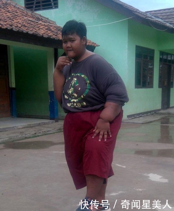 男孩|曾经那个世界最胖的男孩!体重384斤,减肥152斤后变帅小伙