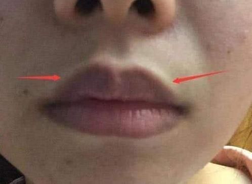 “子宫”干净的女生,脸上不会出现这“3迹象”,00后也要注意了!