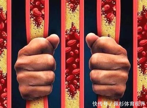 如何预防血栓?提醒:每天4件事,赶走血栓,不用花钱