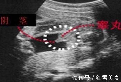 宝宝|原来男宝宝的B超是这样的,四维彩超单上的暗示,准妈妈你知道吗
