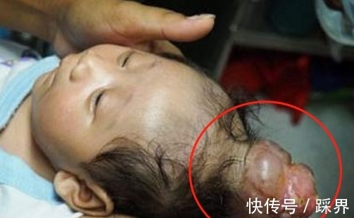 独角兽|奇闻;怀胎十月生下“独角兽”,得知检查结果后奔溃,结局暖心