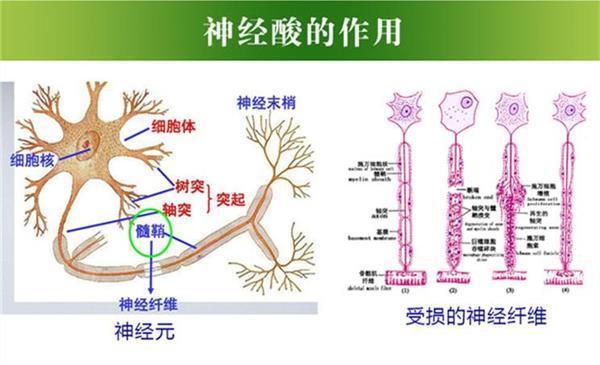 冠状动脉|预防和治疗脑梗心梗的好方法