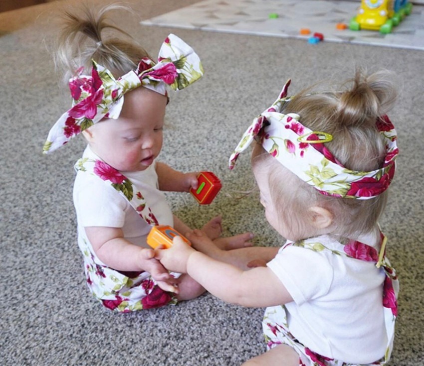 病症|产妇生下唐氏双胞胎姐妹,并没有放弃,网友唐宝都有一张国际脸