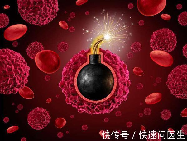 癌症患者|癌症：先用化疗控制病情？但化疗会扩散癌细胞，是真是假？