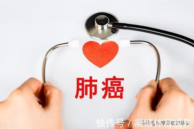 末端|别把肺癌当成关节炎,手指若有一个表现,可能是肺部在“求救”