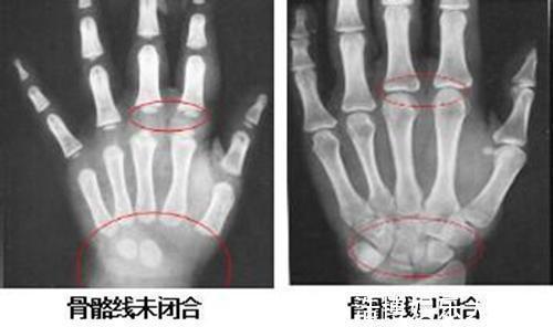 炒饭|会偷走孩子身高的2种“食物”,家长再不阻止,孩子长大要怪你了