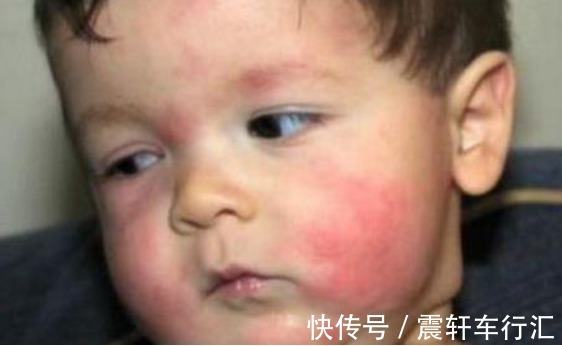 菌群|一碗粥竟差点要了8个月孩子的命,儿科医生:宝宝进食需要谨慎!