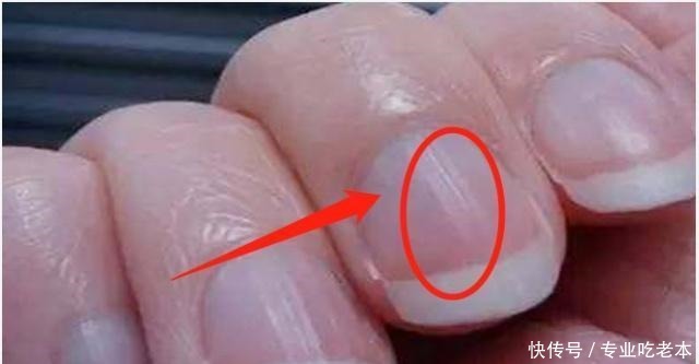 肝好的人,手上会有这4种情况,你若都有,肝脏很健康!