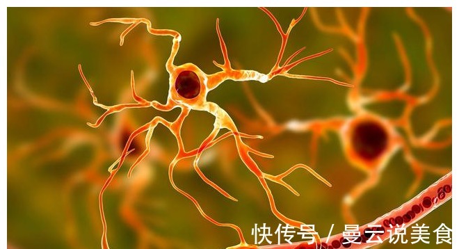 血管堵塞|为何“中风”越来越多提醒血管“溶栓剂”多吃点,中风不来扰