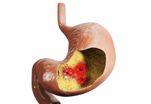 劝告:长期喝酒,若身体出现这4个信号,最好别再喝了