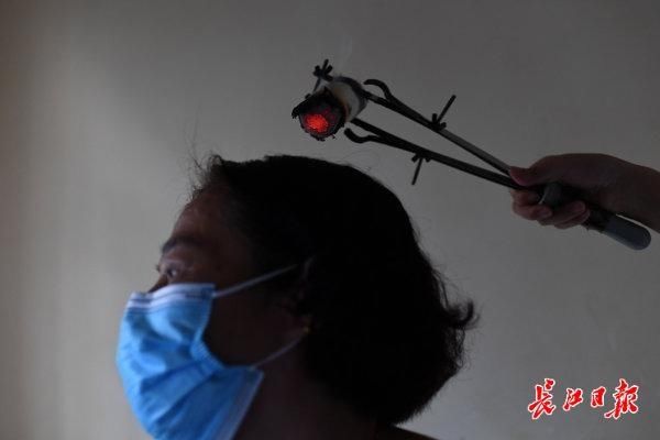 国医堂|火罐“拔出”中医热