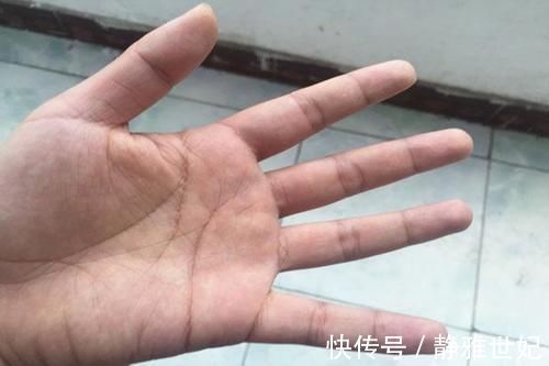 秘诀|得糖尿病12年,血糖稳定在6左右,说出秘诀:利用手掌控制食量