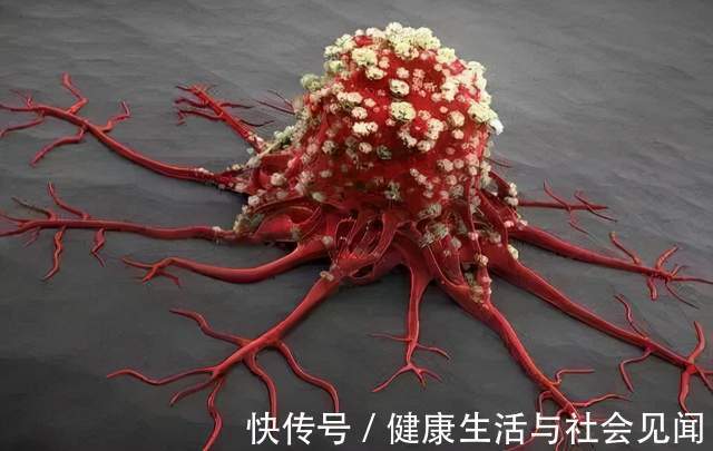 胰腺癌|癌症来临前,身体已经提醒你9次,还是很多人一次次错过了,如何科学预防癌症?