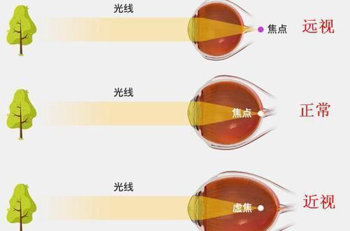 孩子|孩子拿手机玩小游戏,电子产品是洪水猛兽,还是益智工具?