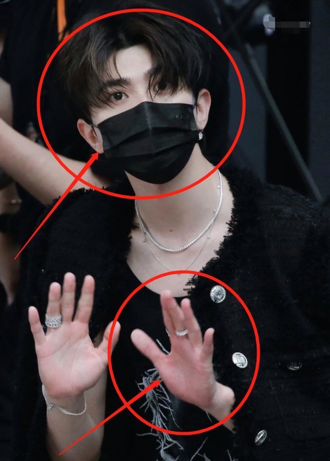 蔡徐坤参加跑男,大夏天穿羽绒服引关注,手臂上的红疹却让人心疼