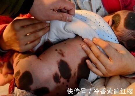 女子|奇闻:32岁女子早产生下“狼孩” 看到孩子,网友:扔掉吧