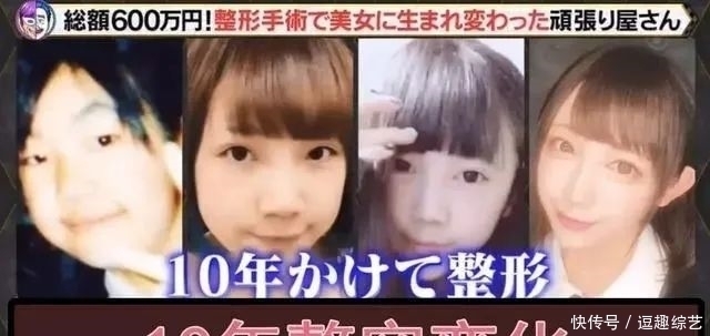 妹子|亲妈鼓励整容，日本妹子十年花600万“变脸”，颜值不输动漫偶像