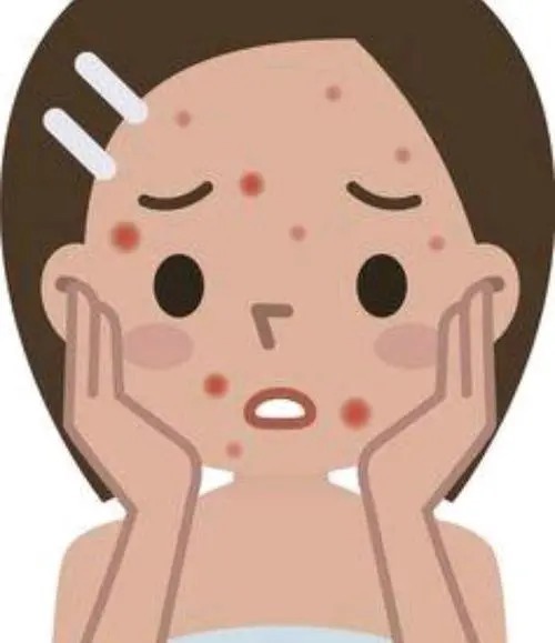 痘痘肌护理的小窍门,爆痘人必看!丨科普篇