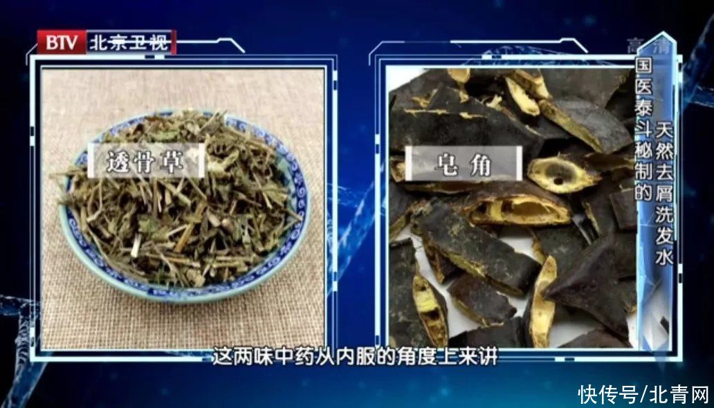 瘢痕性脱发|4种脱发类型，最危险的竟然是它！生发果+固发操，双管齐下，还你靓丽秀发