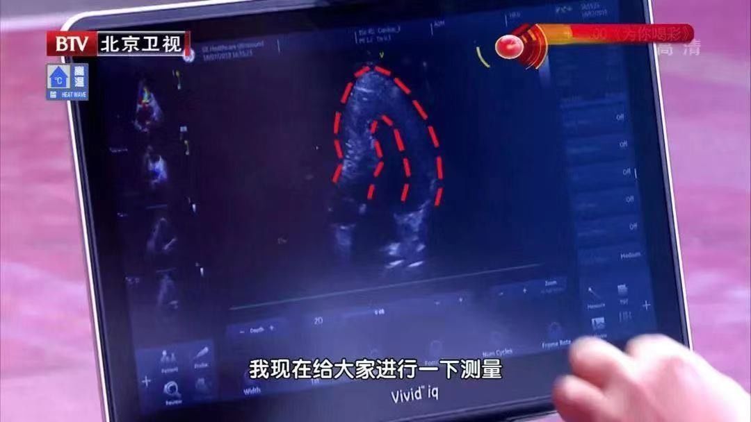 血流|2年没复查，息肉变成癌！B超报告里出现“这些字眼”可能就危险了，别等严重时才后悔