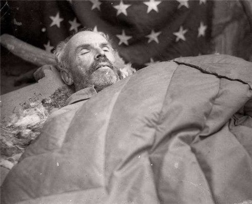 舍命|白求恩舍命救下那个士兵后,不幸感染离世,被救活士兵后来怎样了