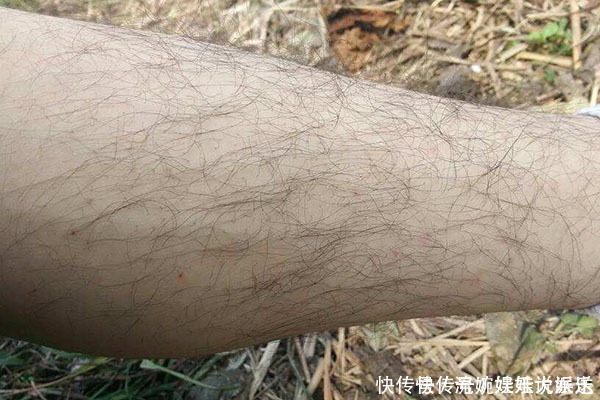 女性|女性体毛旺盛可能是四个原因导致的，你属于哪一种，建议自测